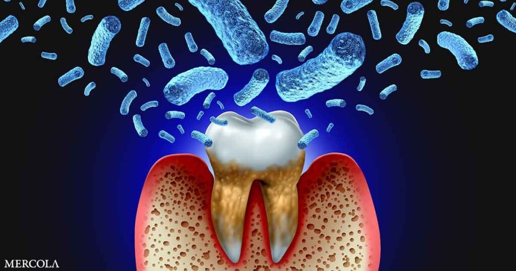 Poor Oral Health Wreaks Havoc on Your Heart and Brain