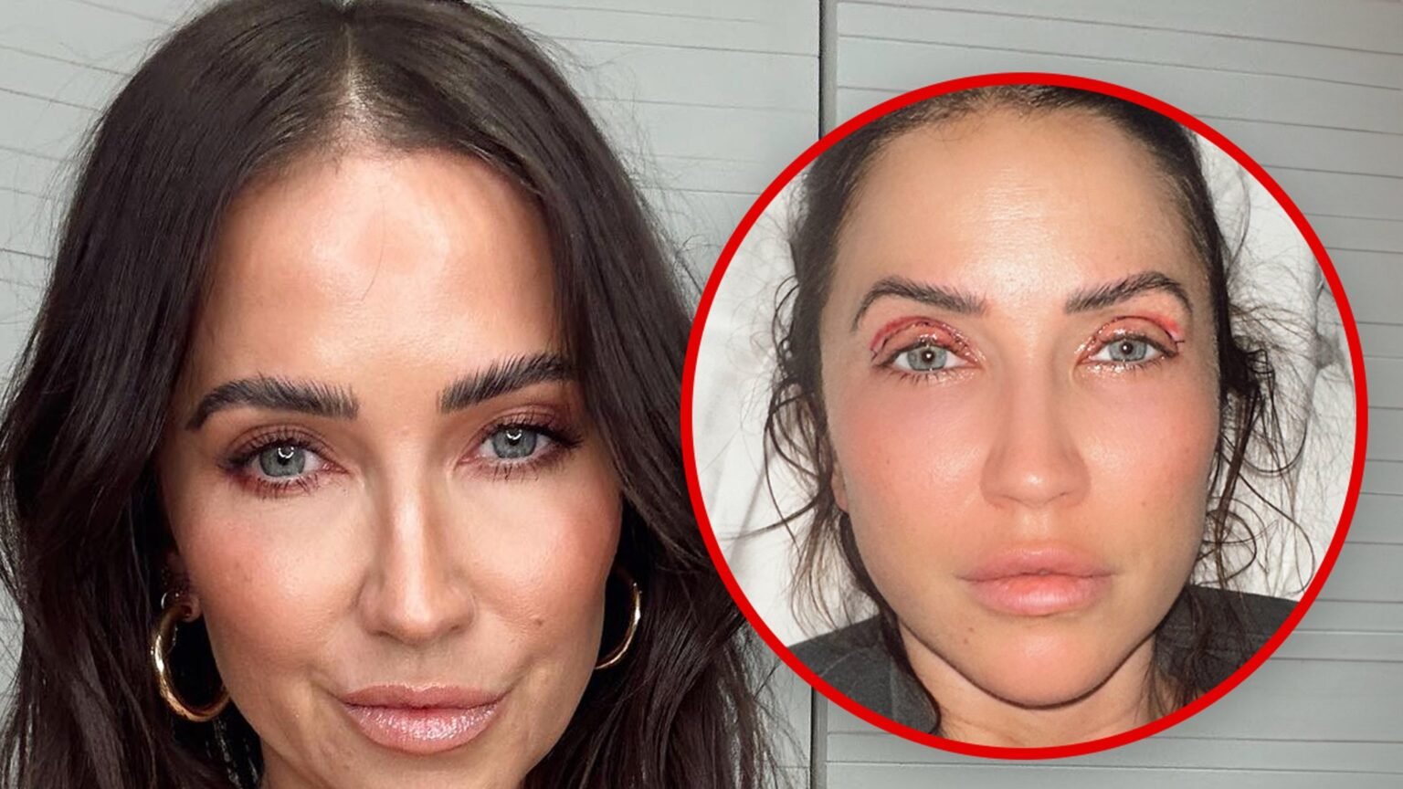 Kaitlyn Bristowe Gets Eyelid Surgery, Pokes Fun With ‘The Devil Wears Prada’ Quote