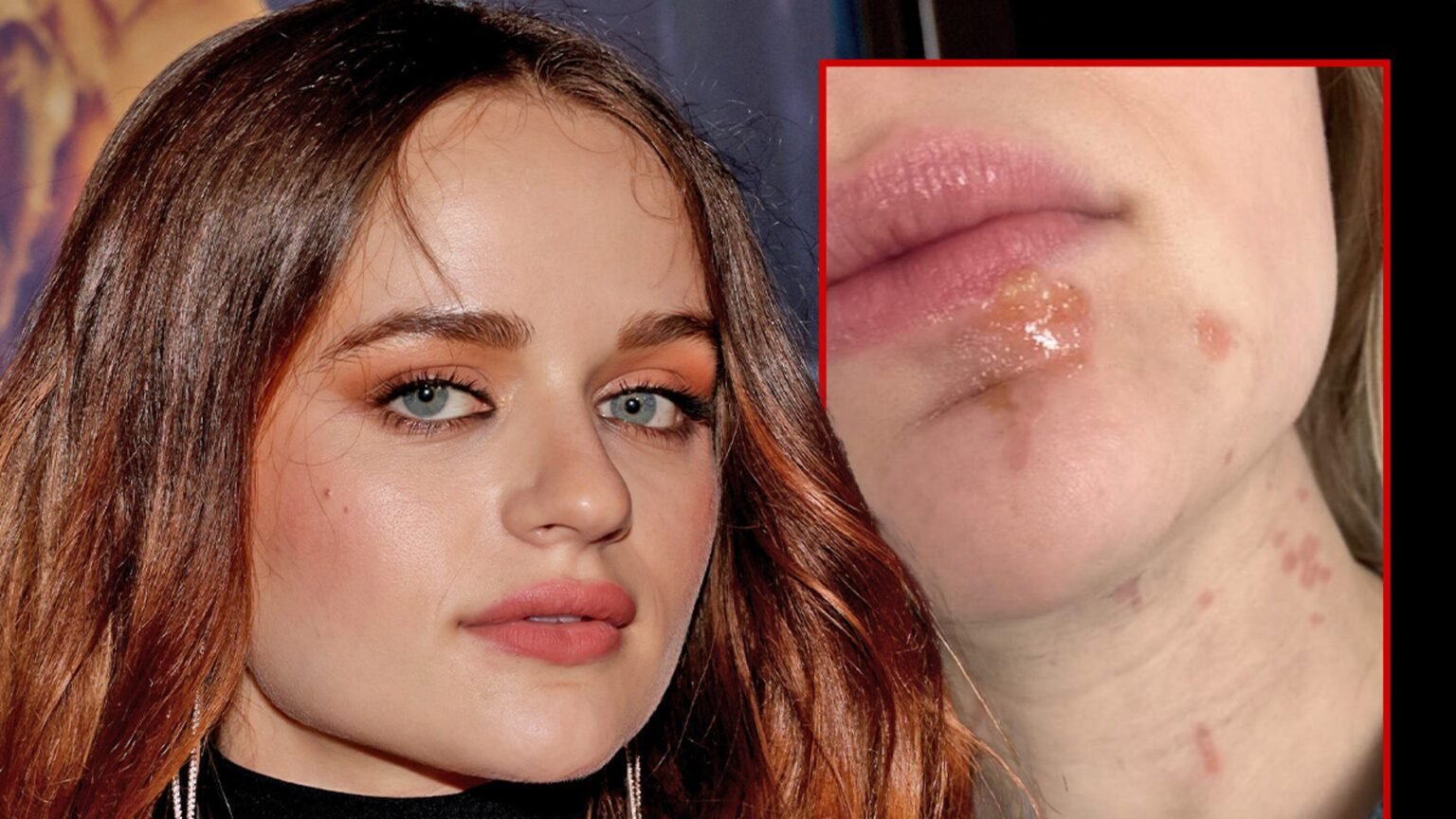 Joey King Ends Up With Facial Burns While Cooking Shallots in Hot Oil