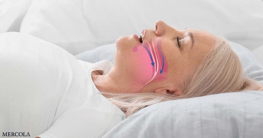 Sleep Apnea Raises Dementia Risk in Older Women