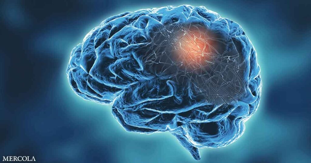 Probiotics Offer New Hope for Alzheimer’s and Other Neurodegenerative Diseases