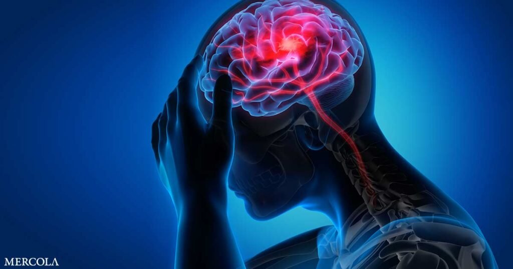 Iron-Overload Identified as a Key Driver of Stroke-Related Injury