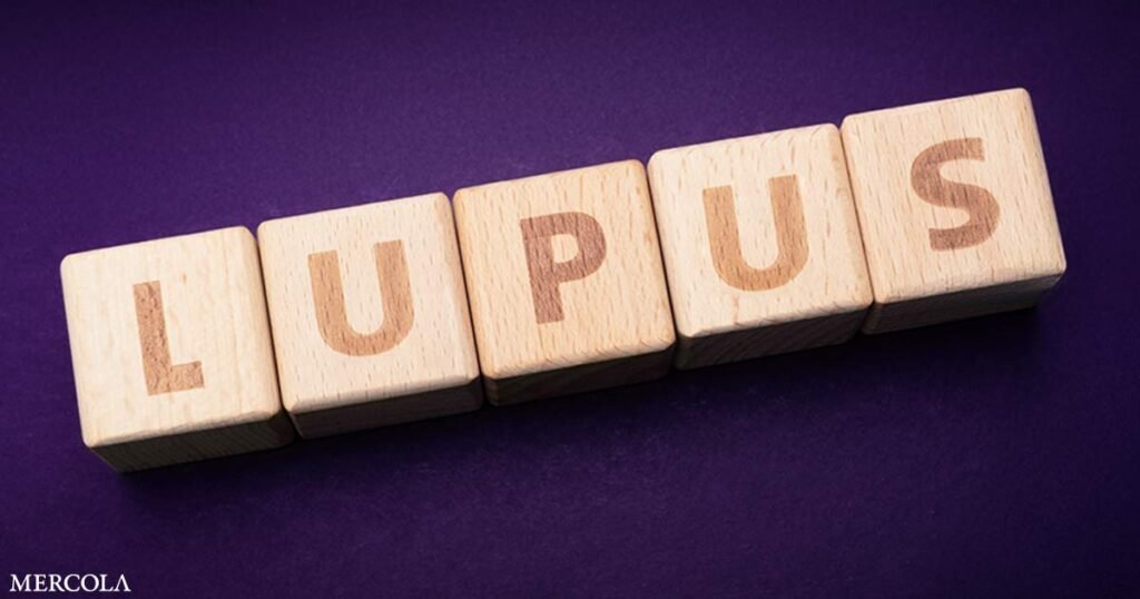 Lupus Facts and Fictions