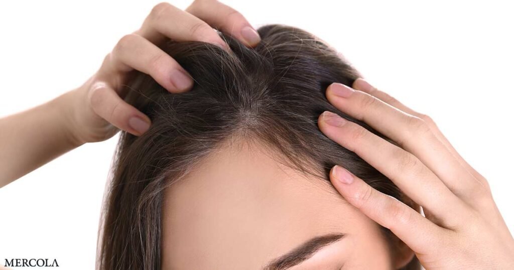 How to Fix Hidden Nutrient Gaps That Trigger Hair Loss