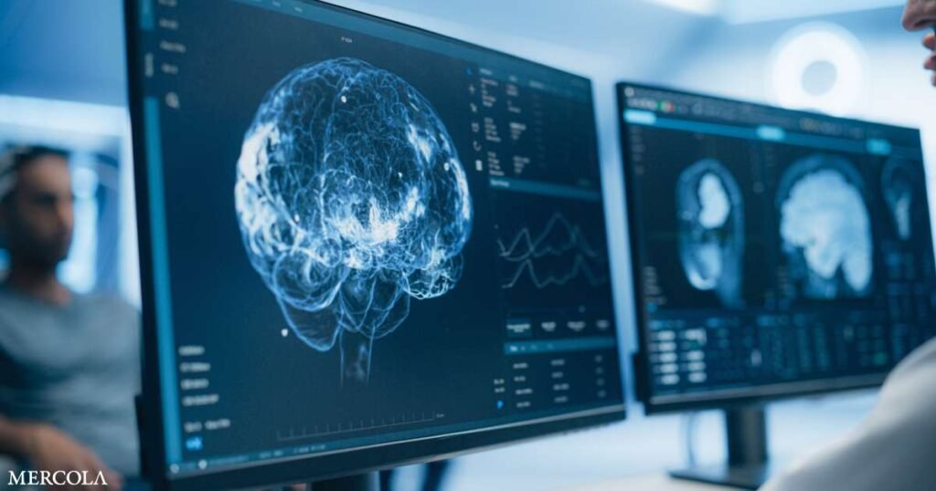 More Than Half of Americans Live with Neurological Conditions